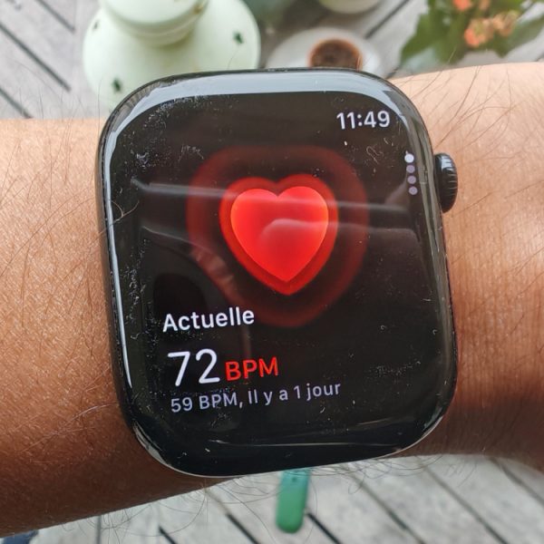 Faut-il se fier aux données de santé de l’Apple Watch ? Une étude répond enfin à la question