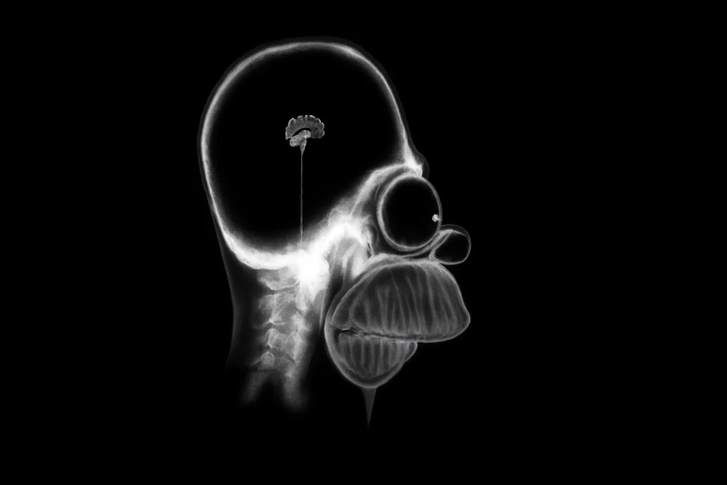 Des chercheurs font pousser un cerveau humain de poche