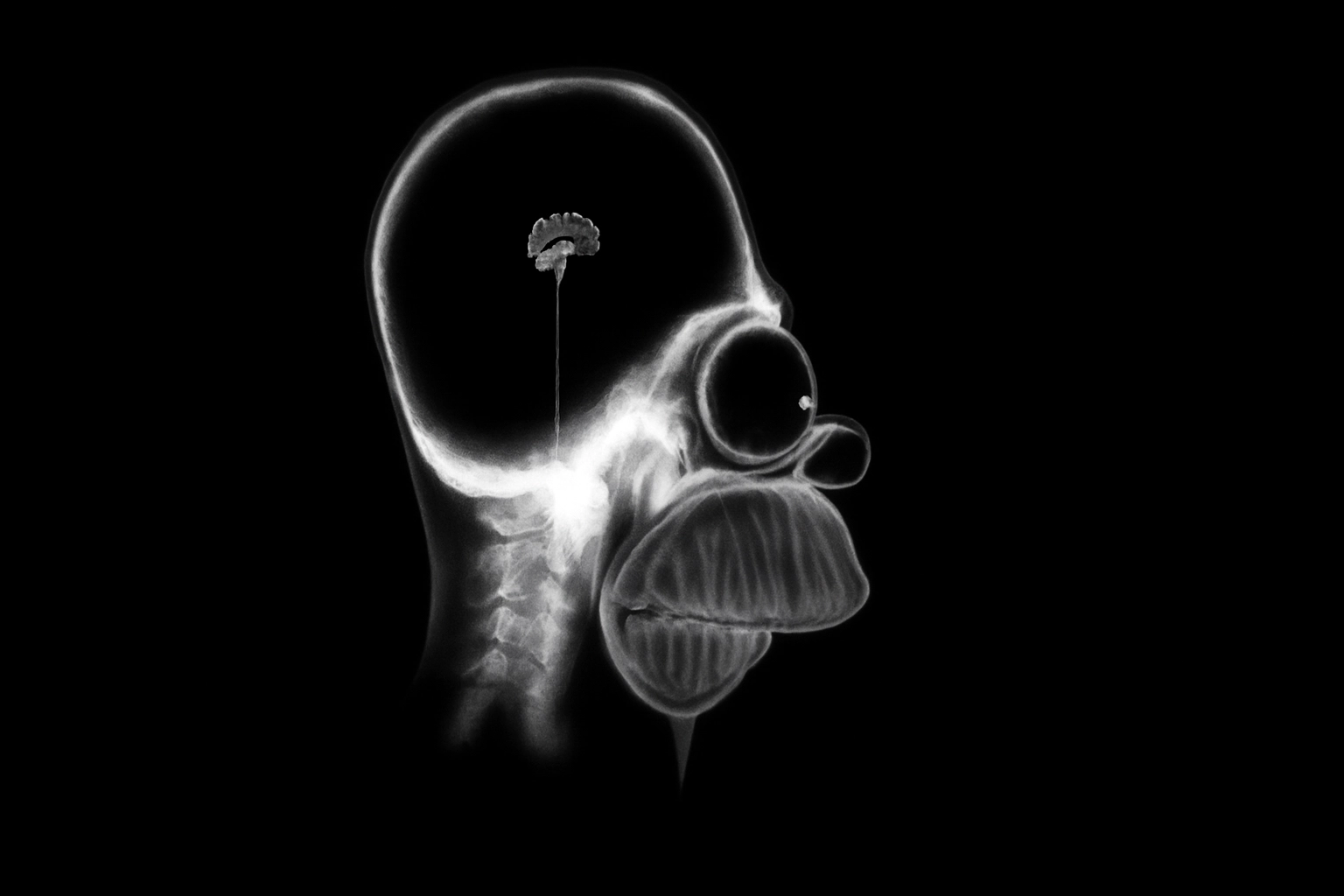 Des chercheurs font pousser un cerveau humain de poche