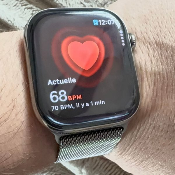 Apple Watch : comment activer les notifications d’hypertension sur watchOS 26 ?