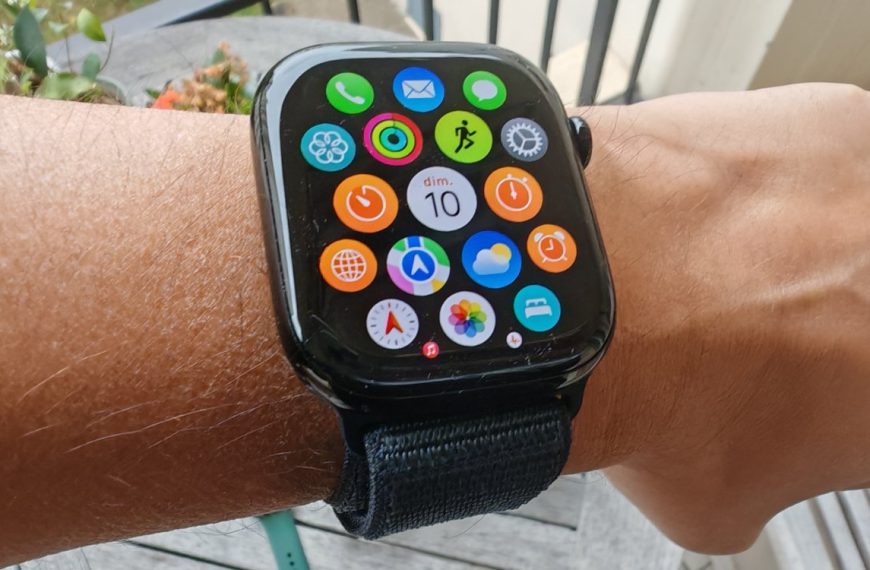 Apple Watch Series 10 : Apple remplace gratuitement certains modèles à cause de ce petit défaut de revêtement