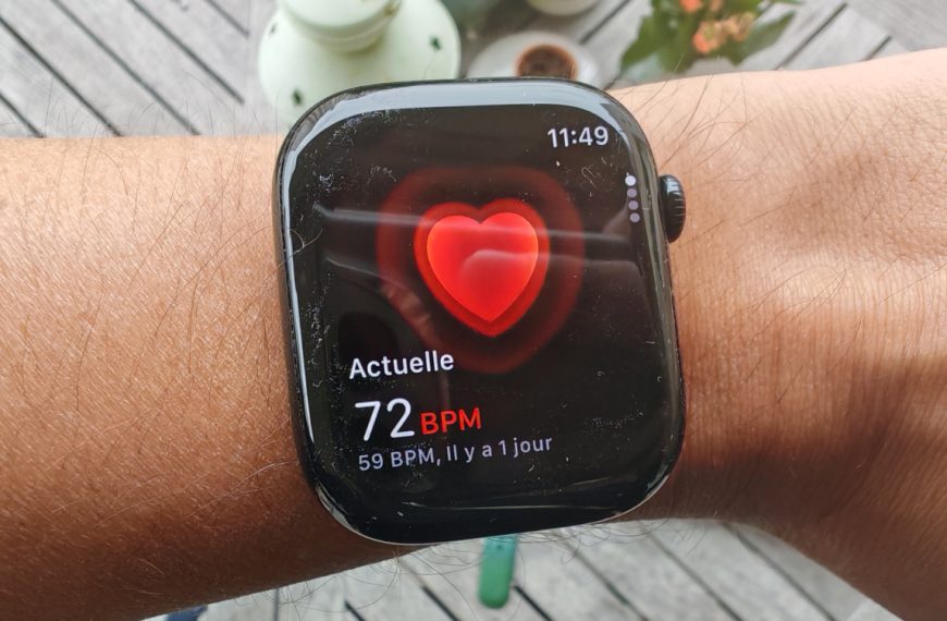 Une Apple Watch gratuite pour tout le monde ? La montre connectée pourrait réduire les coûts de santé