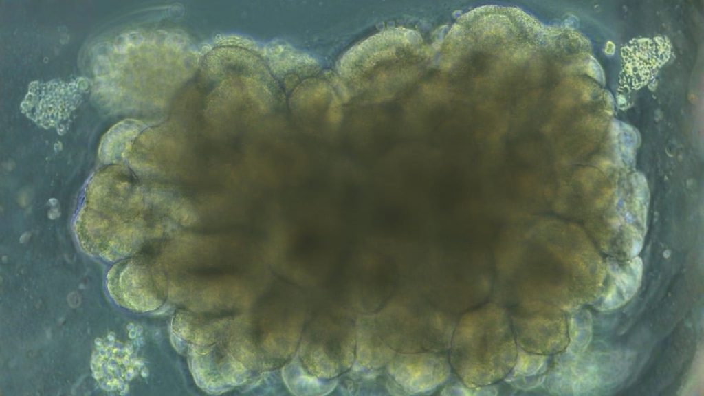 Des mini-cerveaux cultivés en labo ont appris à résoudre un problème d'ingénierie