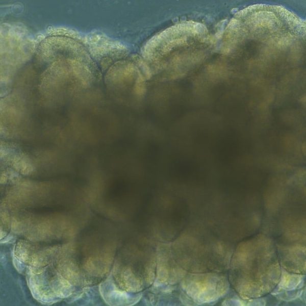 Des mini-cerveaux cultivés en labo ont appris à résoudre un problème d'ingénierie