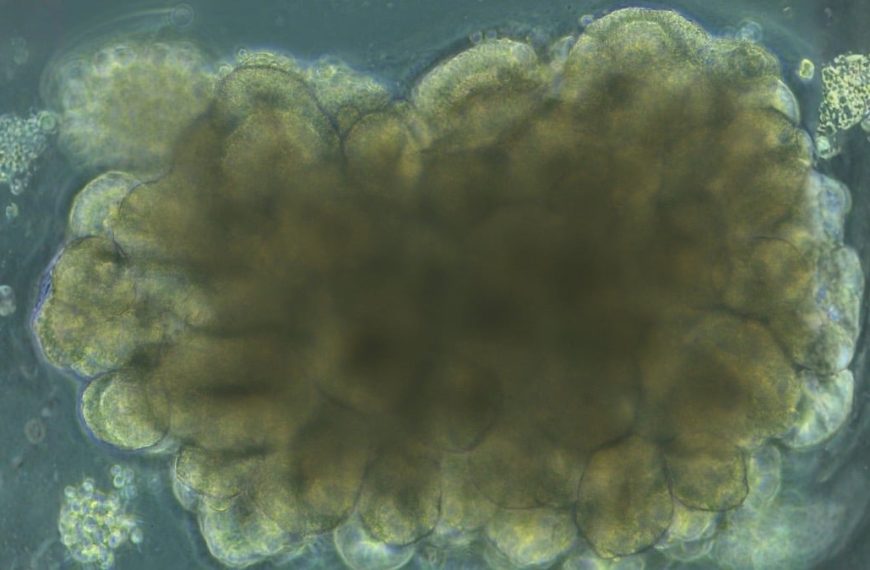 Des mini-cerveaux cultivés en labo ont appris à résoudre un problème d'ingénierie