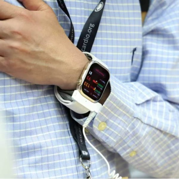 Huawei lance la Watch D3, une montre connectée médicale avec mesure précise de la pression artérielle