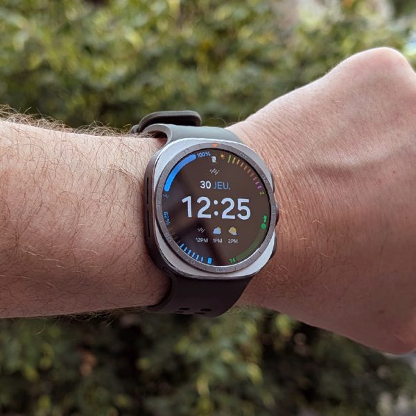 Galaxy Watch : plusieurs modèles sont accusés d’être responsables de brûlures (et ce n’est pas beau à voir)