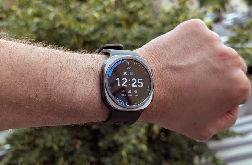 Galaxy Watch : plusieurs modèles sont accusés d’être responsables de brûlures (et ce n’est pas beau à voir)